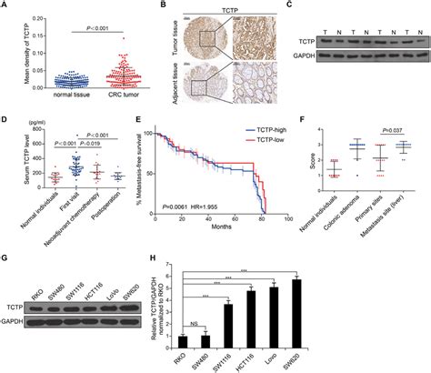 Tctp Is A Potential Biomarker Of Crc A The Expression Levels Of Tctp