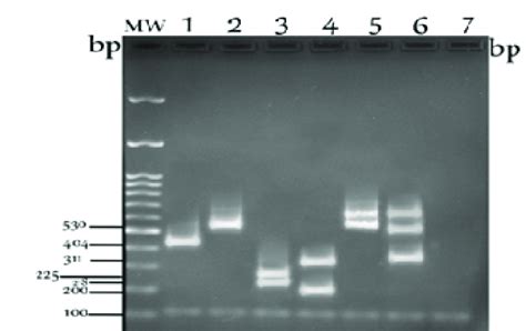 Agarose Gel Electrophoresis Showing 6 Pcr Rflp Patterns Of Types I To