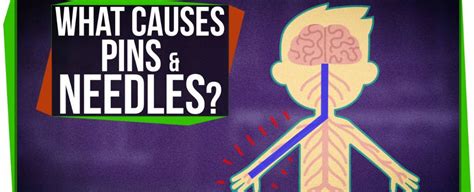 Watch: What Causes Pins And Needles? : ScienceAlert