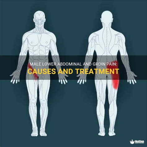 Male Lower Abdominal And Groin Pain: Causes And Treatment | MedShun