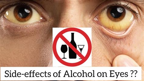 8 Side Effects Of Drinking Alcohol To Your Eyes Drinking Alcohol Is