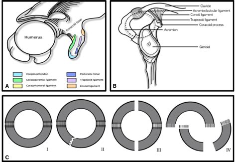 A The Coracoid Process And Its Attached Anatomical Structures Superior Download Scientific