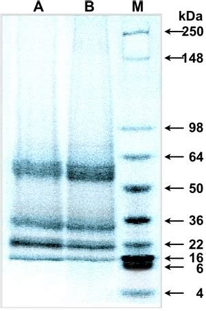 Sds Page Separation Of Protein Extracted By Different Methods Lane A