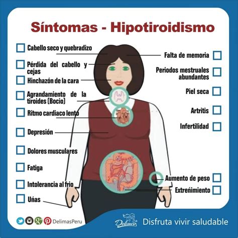 Hipotiroidismo Qu Es S Ntomas Causas Y Tratamiento Blog Vive Sano