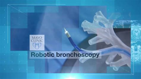 Robotic bronchoscopy - Mayo Clinic