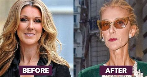 Celine Dion Weight Loss Journey Diet Exercise Before And After Photos