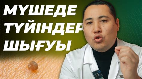 Мүшеде түйіндер қаптап кетті! Әйелдерге жұғу өте қауіпті! ВПЧ, Папилома ...