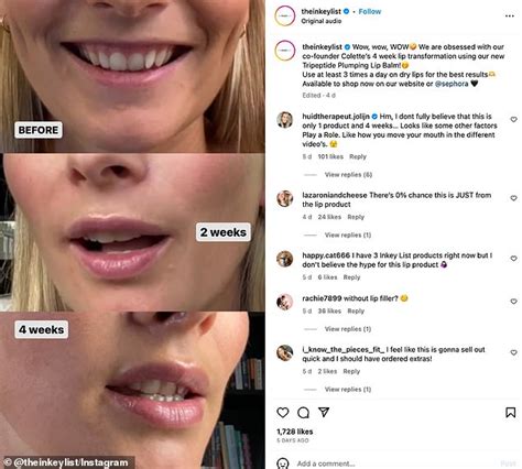 Lip Balm Or Lip Filler Beauty Fans Are In A Frenzy Over New 10 99