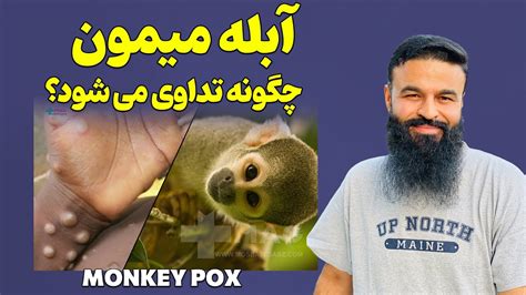 آبله میممون چگونه تداوی می شود دکتور قیس نیکزاد YouTube