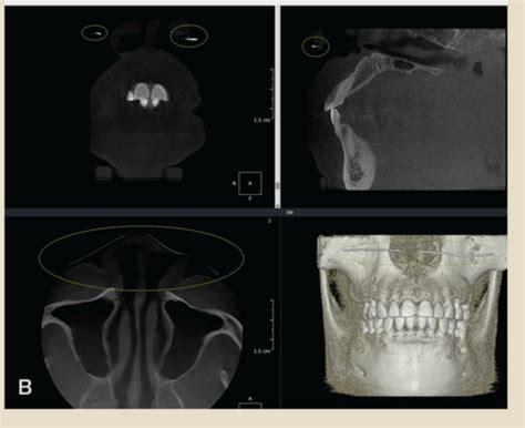 Chapter Three Dimensional Digital Imaging Flashcards Quizlet