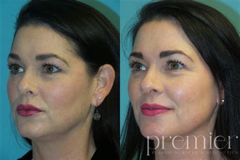 Skin Care Gallery Premier Plastic Surgery