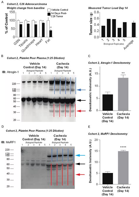 Western Blot Analysis Of Platelet Poor Plasma Atrogin And Murf In