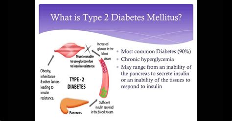 Etiologi Diabetes Melitus Tipe 1