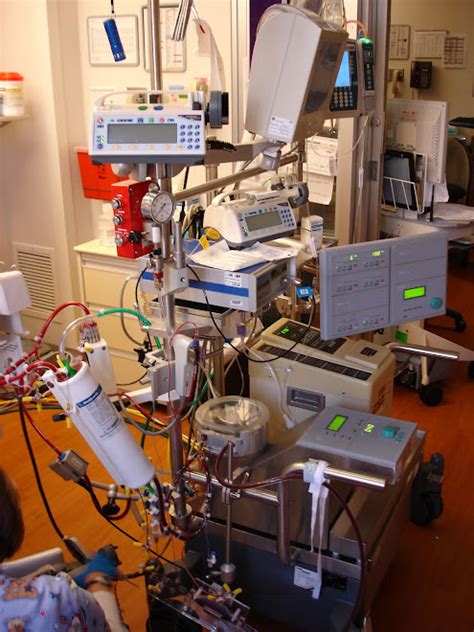 The Journey Of Ellis Still On Ecmo