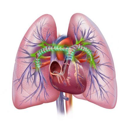 Devicemd Ekosonic Endovascular System