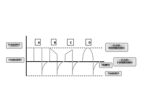 Fundamentals Of Mechanical Ventilation Ppt