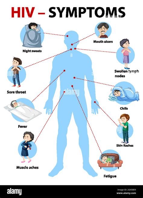 Infographie sur les symptômes de l infection à VIH Image Vectorielle