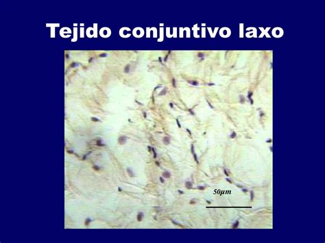 Ppt Tejido Conjuntivo Prof Nahyr Cancela Powerpoint Presentation