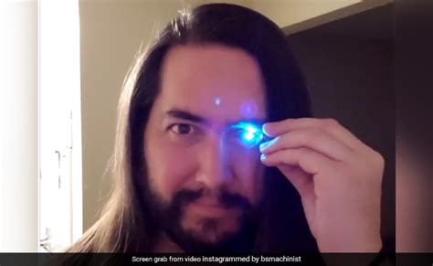 कैंसर से एक आंख खोने के बाद शख्स ने लगवा ली Flash Light देखें Video Converted Eye Into