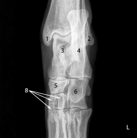 Tarsus Radiograph Diagram Quizlet