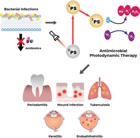 Antimicrobial Photodynamic Therapy For The Remote Eradication Of Bacteria Yan 2023