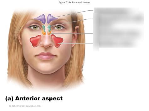 Paranasal Sinuses