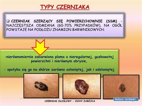 PPT - CZERNIAK PowerPoint Presentation, free download - ID:4598287
