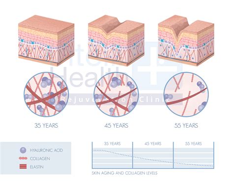 Anti-aging Treatment - Rejuvenation Treatments book now 026507709