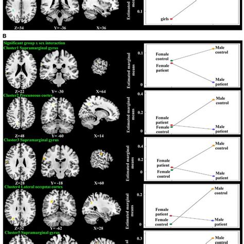 Significant Mean Activation Sex Effect A And Group By Sex