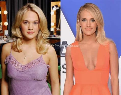 Carrie Underwood: BEFORE and AFTER