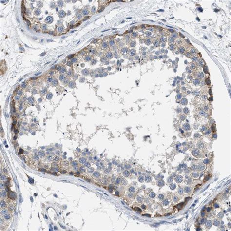 Rabbit Polyclonal Anti Bnc2 Antibody Buy For Research Highly