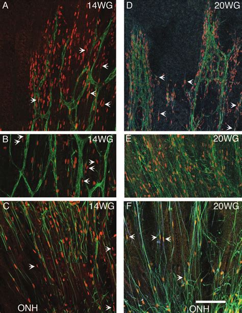 Human Fetal Retinal Wholemounts Triple Labeled With Pax2 GFAP CD34 At