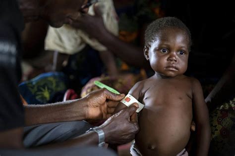 Crise Alimentaire Mondiale Un Nouveau Cas De Malnutrition S V Re Par