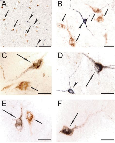 Representative Photomicrographs Showing Double Immunolabeling For Hcrt Download Scientific