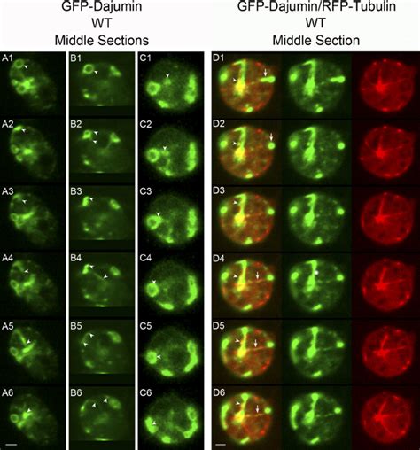 CV Membranes Move Bidirectionally On Microtubules Between The Cortex