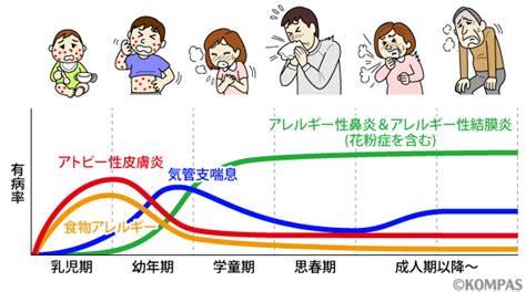 新薬が続々登場！アレルギー疾患の治療革命 ―アレルギーセンター ―｜kompas