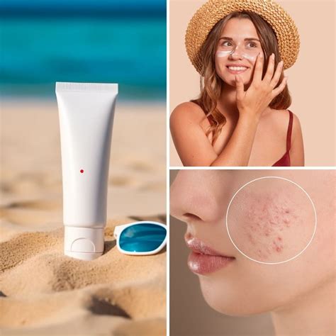 The Best Sunscreen For Acne Prone Skin