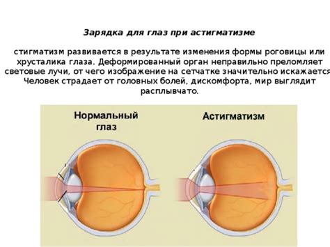 Упражнения для зрения