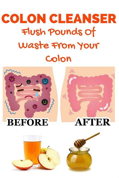 What You Need To Know About Colon Cleanse | Natural colon cleanse ...