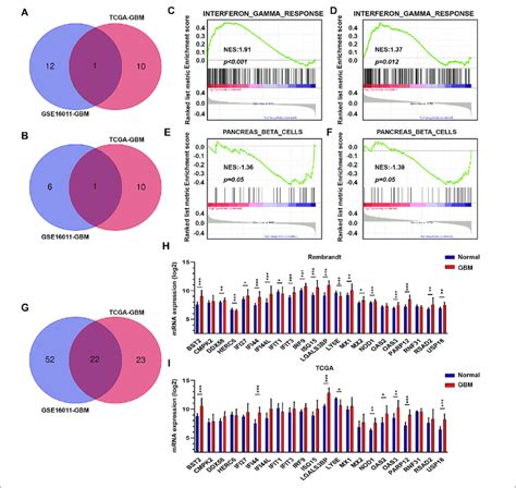 The Interferon γ Signature Is Associated With Differences In Gbm