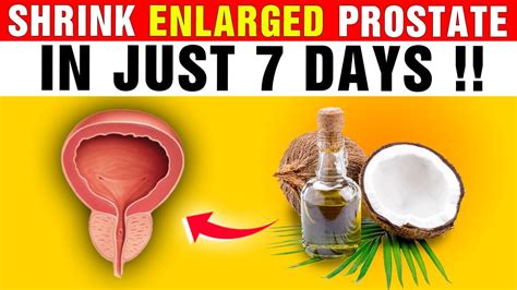 Shrink Prostate Fast Try This One Oil For 7 Days To Shrink An Enlarged