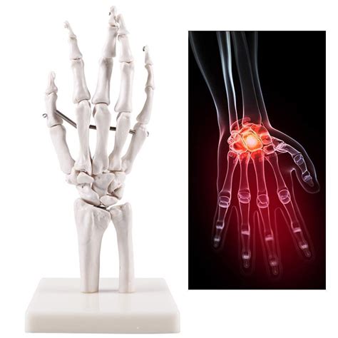 Buy Educational Model Life Size Hand Skeleton Model Human Hand And