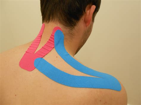 Kinesiotaping O Vendaje Neuromuscular