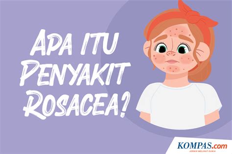 Penyakit Rosacea Gejala Penyebab Pengobatan Kompas