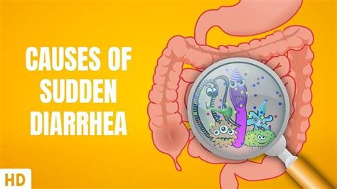 Stool Chronic Diarrhea at Cheryl Andrews blog