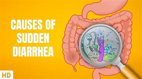 Causes Of Sudden Diarrhea Youtube