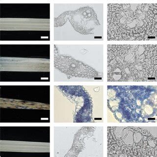 Trypan Blue Staining On The Leaves Of Zj Zj Lm And Zj Lm R Sampled