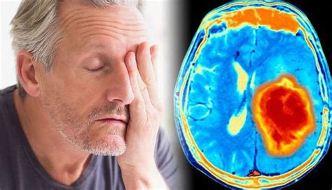 3 Major Causes and Symptoms of Brain Tumor - lifeberrys.com