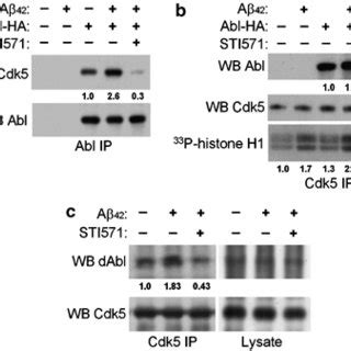 A Triggered Abl Kinase Activity Is Required For Ablcdk Interaction