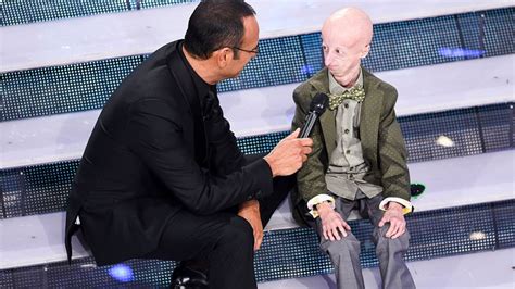 Como a progeria faz crianças parecerem idosos